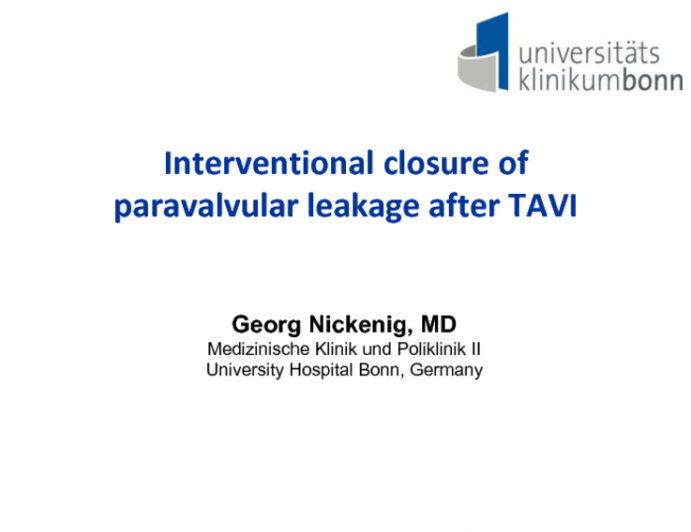 Undersized TAVR with Paravalvular Regurgitation