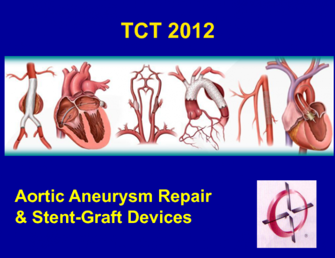 Aortoiliac Aneurysmal Disease: Optimal Repair Techniques Using Available Devices