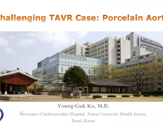 Case 1: TAVR by Transaortic Approach in a Patient with Severe Aortic Stenosis and Peripheral Arterial Disease