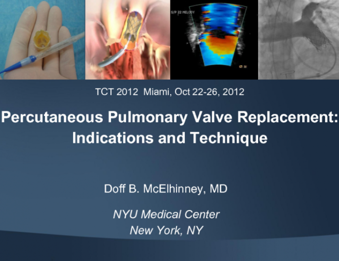 Percutaneous Pulmonary Valve Replacement: Indications and Technique