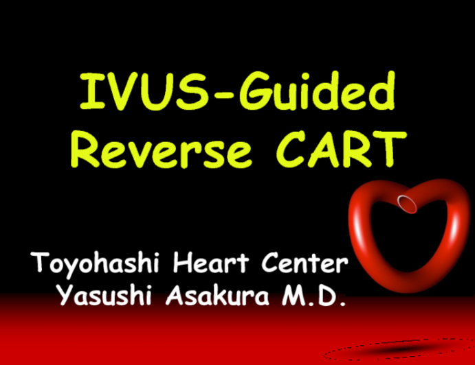 IVUS-Guided Reverse CART