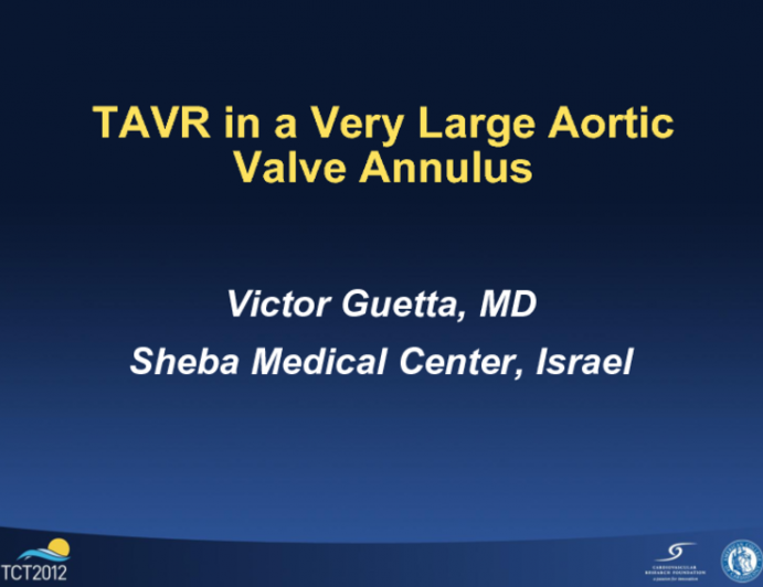 TAVR in a Very Large Aortic Valve Annulus