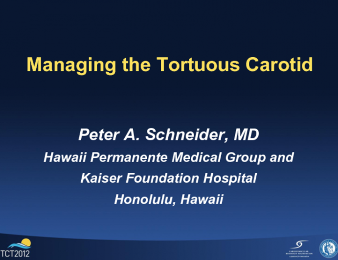 Managing the Tortuous Carotid