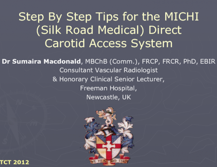 Step-by-Step Tips for the MICHI (Silk Road Medical) Direct Carotid Access System