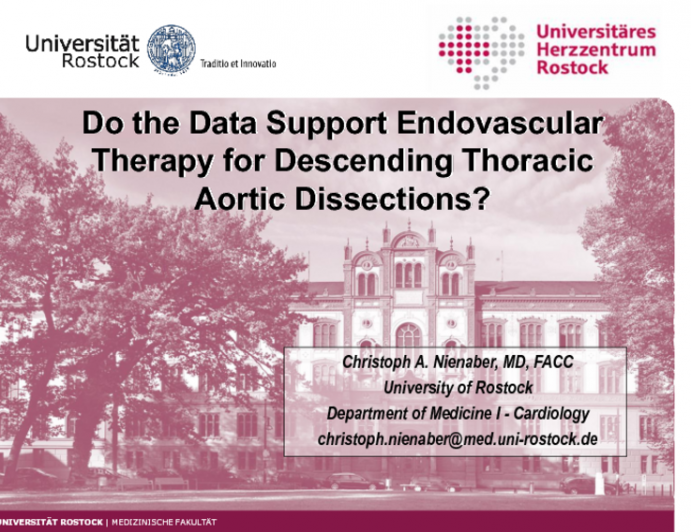 Debate: Do the Data Support Endovascular Therapy for Descending Thoracic Aortic Dissections? Con!