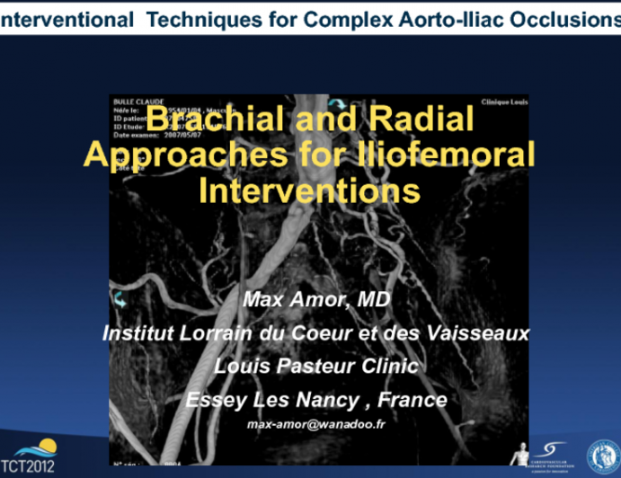 Brachial and Radial Approaches for Iliofemoral Interventions