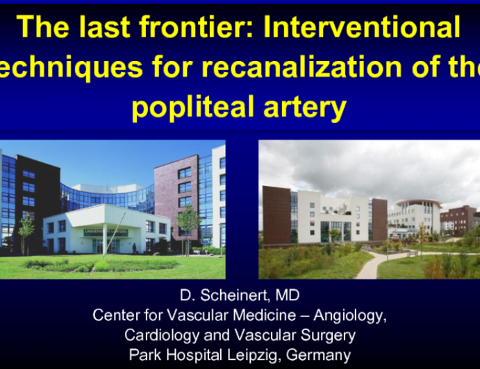 The Last Frontier: Interventional Techniques for Recanalization of the Popliteal Artery