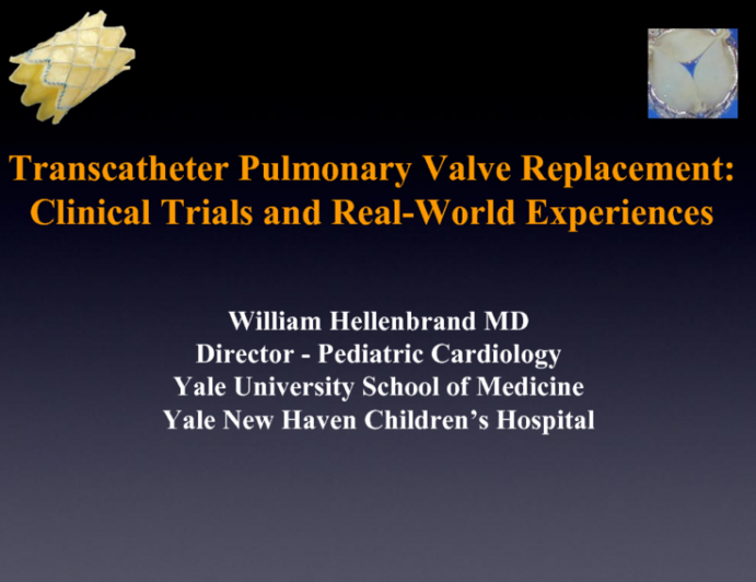 Transcatheter Pulmonary Valve Replacement: Clinical Trials and Real-world Experiences