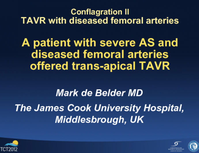 Case Presentation Introduction: Patient with Severe AS and Diseased Femoral Arteries Offered Transapical TAVR