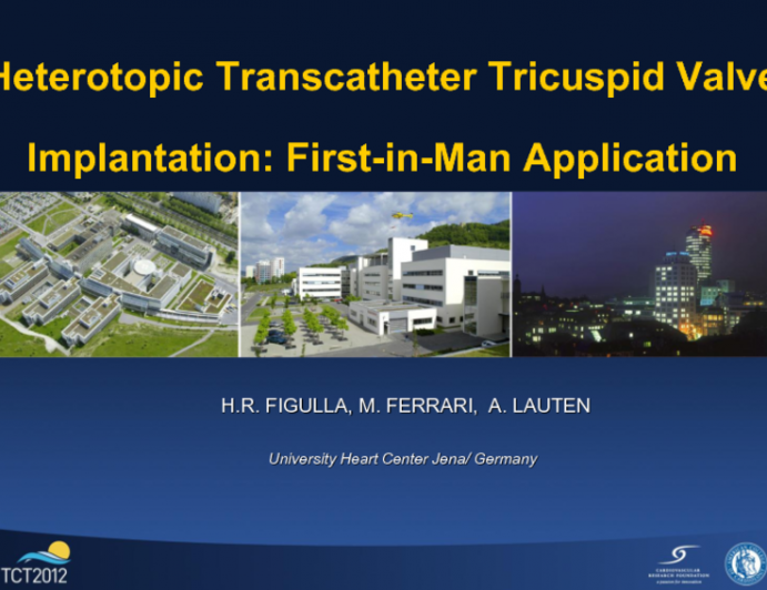 Taped Case 3: Heterotopic Transcatheter Tricuspid Valve Implantation for Patients with Severe Tricuspid Regurgitation