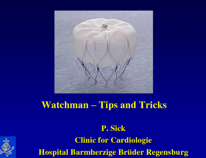 WATCHMAN Tips and Tricks