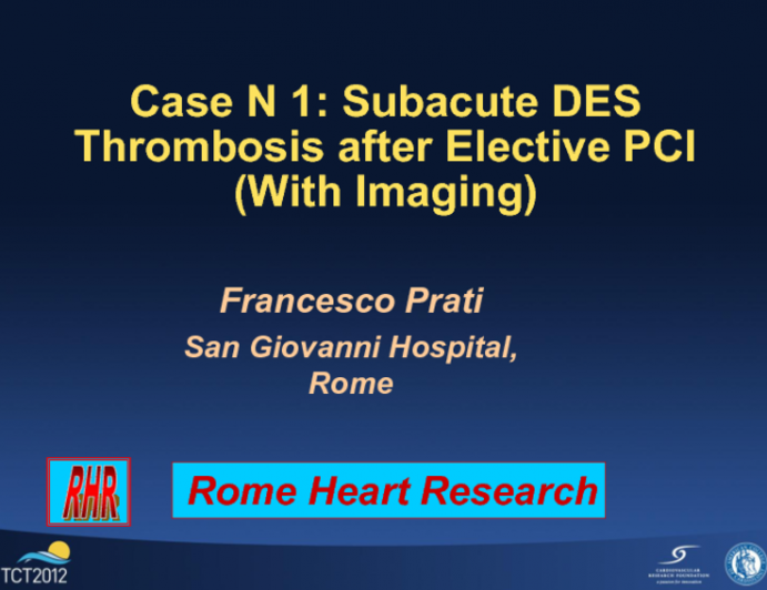 Case 1: Subacute DES Thrombosis After Elective PCI (with Imaging)