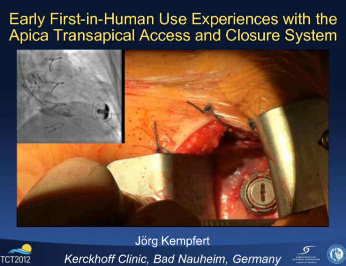 Early First-in-Human Use Experiences with the Apica Transapical Access and Closure System