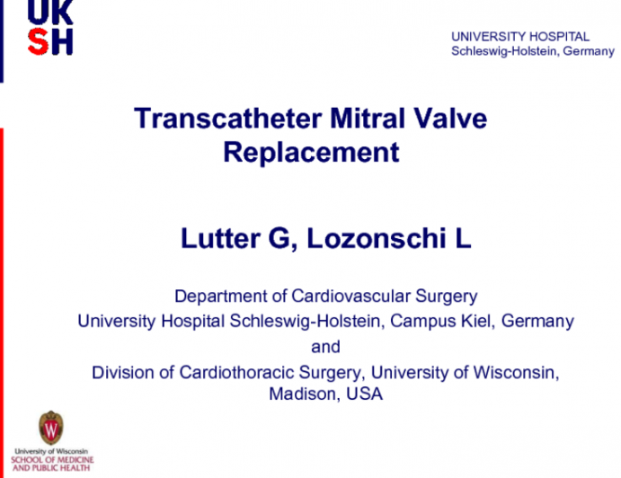 Lutter Valve Update