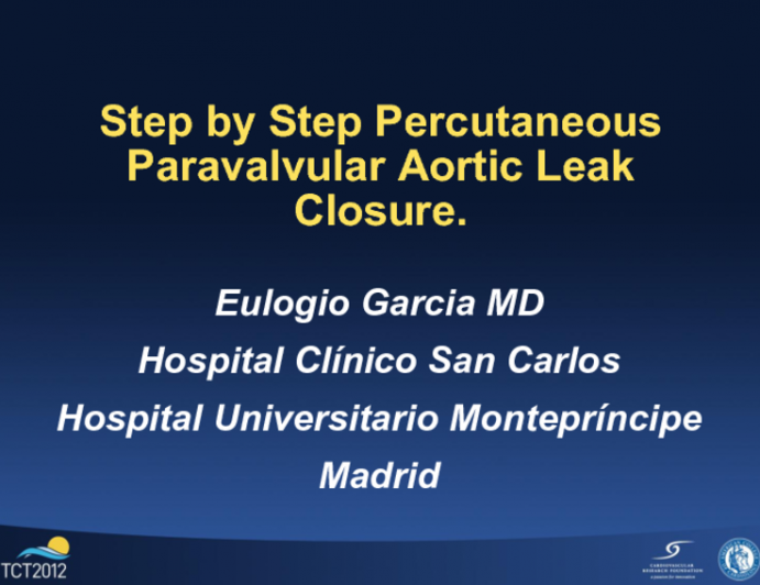 Percutaneous Closure of an Aortic Paravalvular Leak: Step by Step Case