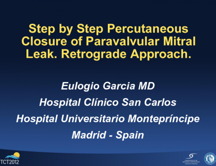 Step-by-Step Case: Percutaneous Closure of Mitral Paravalvular Leak: Retrograde Approach