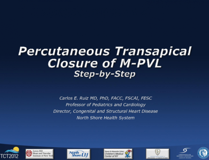 Step-by-Step Case: Closure of Mitral Paravalvular Leak: Transapical Approach