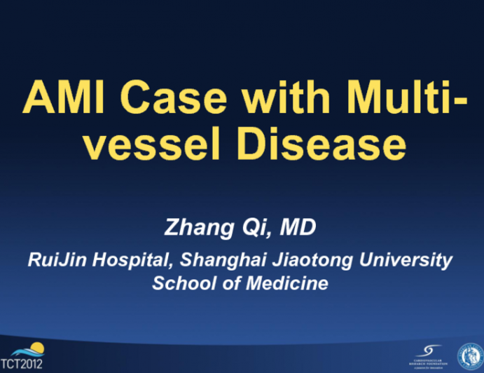 Case Presentation: STEMI with Multivessel Disease