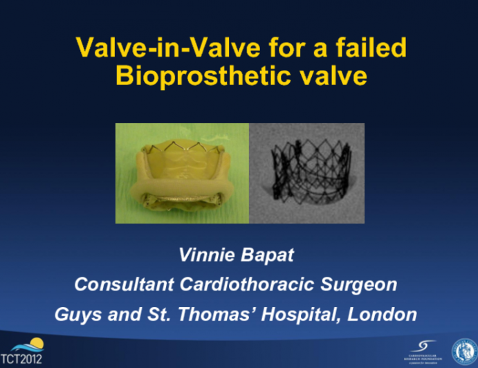 Valve-in-Valve for Failed Bioprosthetic Valves