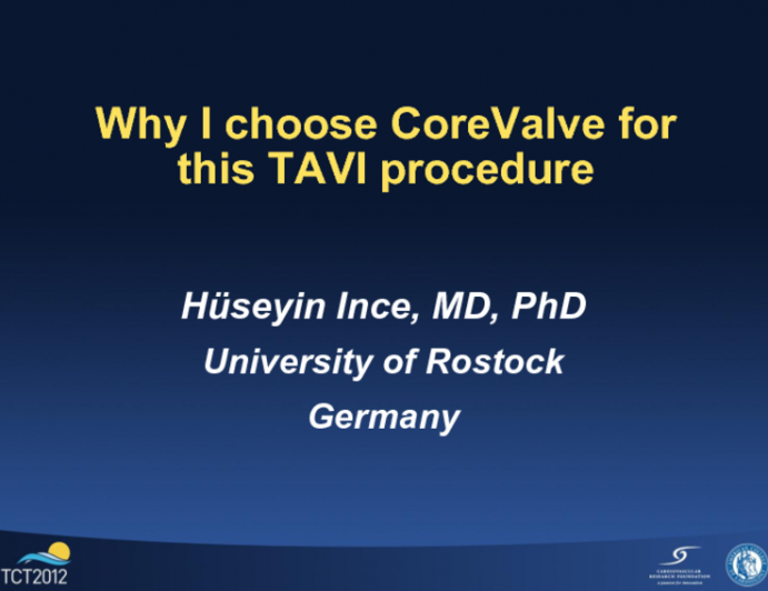 Why I Chose CoreValve for This TAVI Procedure