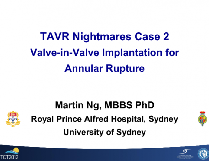 Case 2: Valve-in-Valve Implantation for Annular Rupture