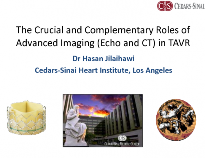 The Crucial and Complementary Roles of Advanced Imaging (Echo and CT) in TAVR