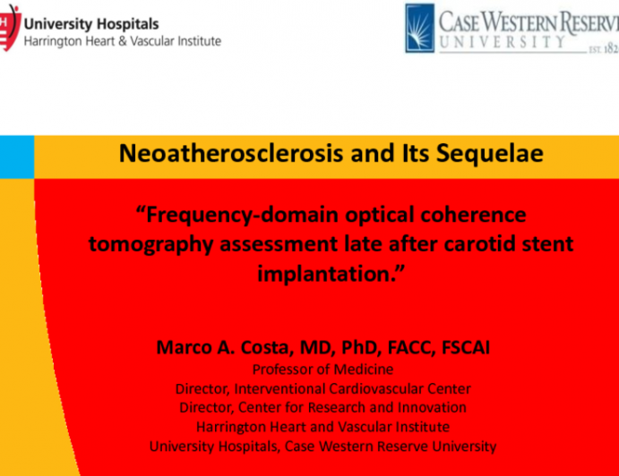 Case Presentation 1: Neoatherosclerosis and Its Sequelae