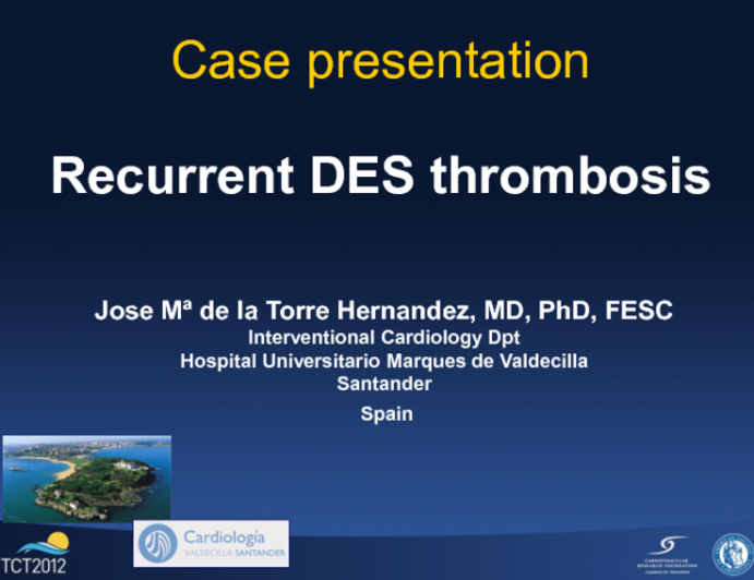 Case Presentation (with Discussion): Recurrent DES Thrombosis