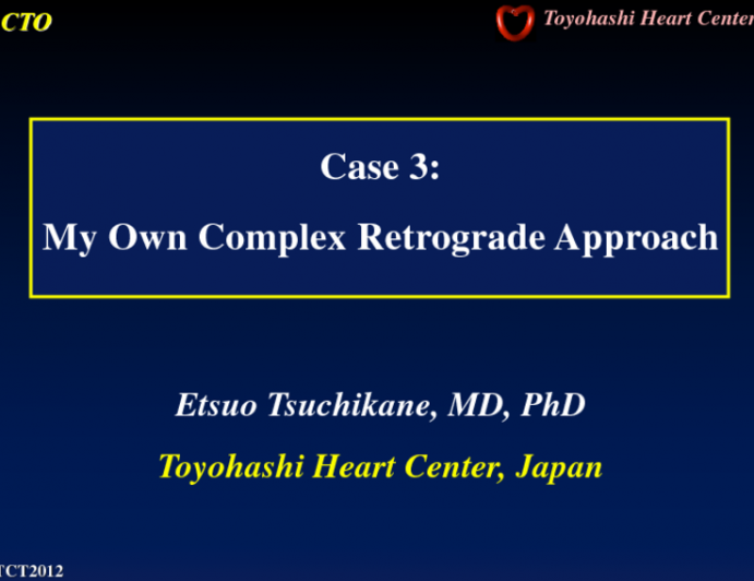 Case 3: My Own Complex Retrograde Approach