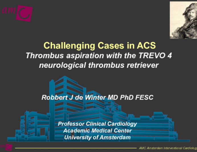 Thrombectomy in Primary PCI Using a Trevo-Device