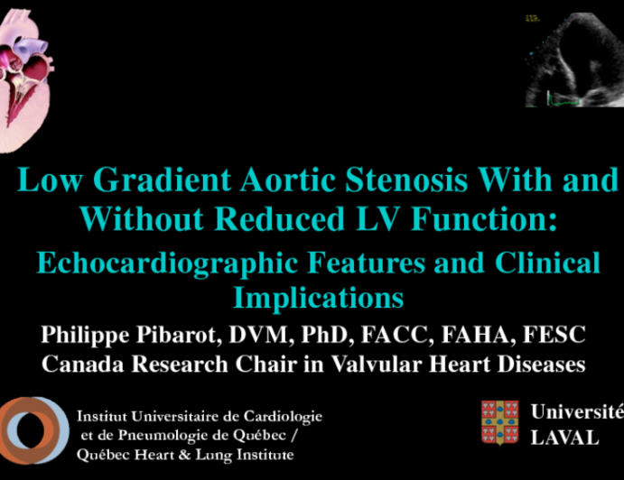 Echocardiographic Features and Clinical Implications