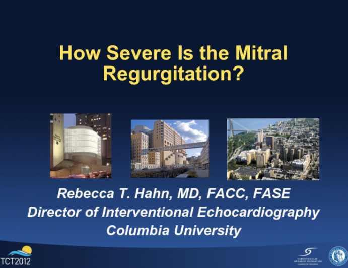 Case Example: How Severe Is the MR in this Patient?