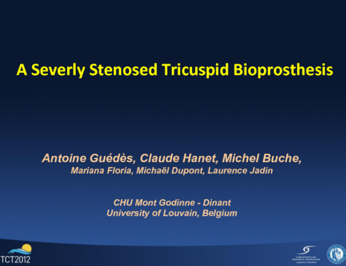 A Severely Stenosed Tricuspid Bioprostheses