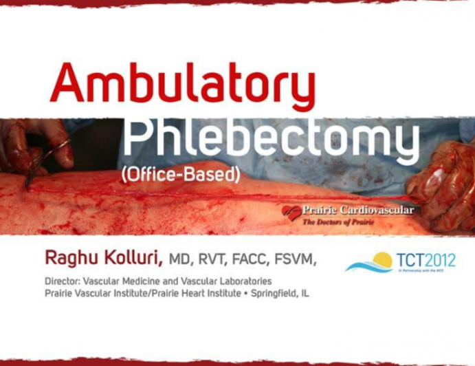 Case 4: Ambulatory Phlebectomy (Office-Based)