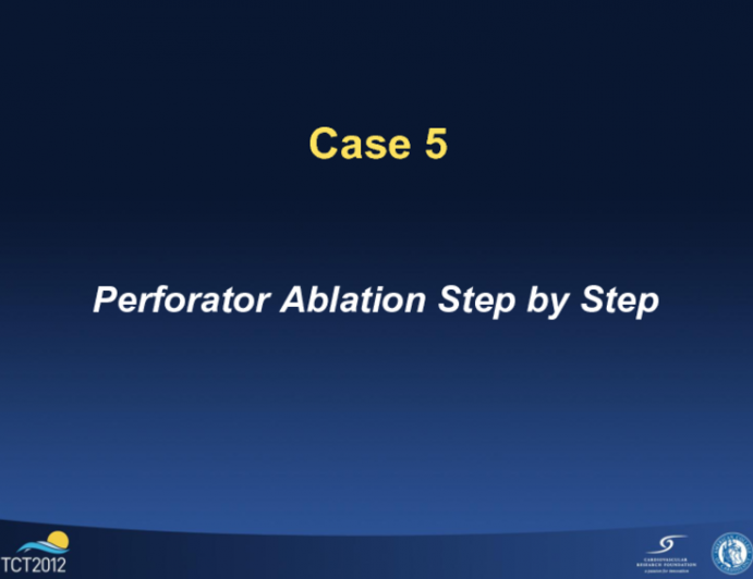 Case 5: Perforator Ablation Step by Step