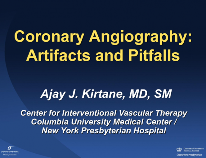 Coronary Angiography II: Artifacts and Pitfalls