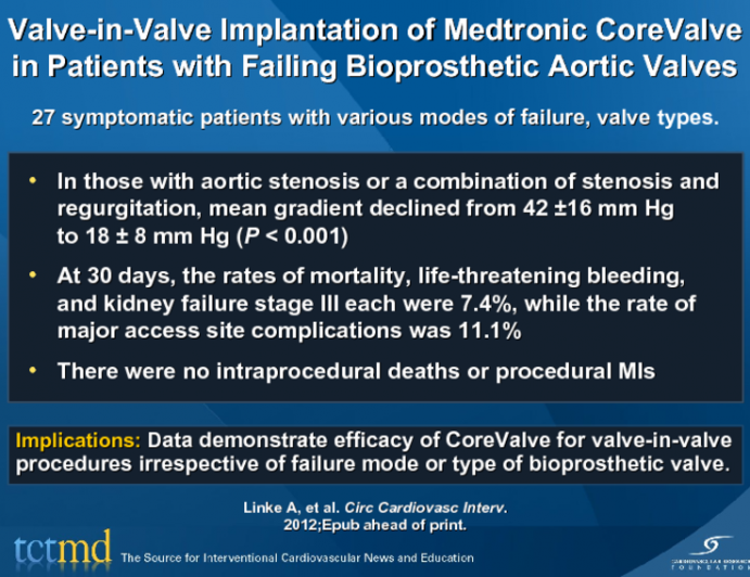 Valve-in-Valve Implantation of Medtronic CoreValve in Patients with Failing Bioprosthetic Aortic Valves