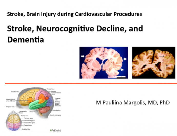Stroke, Neurocognitive Decline, and Dementia
