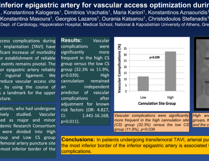 Using Inferior Epigastric Artery For Vascular Access Optimization During Transcatheter Aortic Valve Implantation.