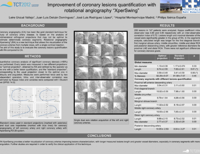 Improvement of coronary lesions quantification with rotational angiography “XperSwing”
