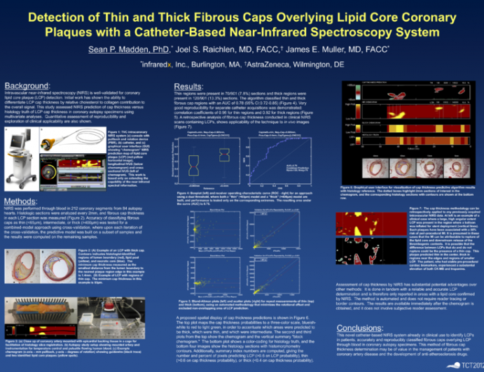 Detection of Thin and Thick Fibrous Caps Overlying Lipid Core Coronary Plaques with a Catheter-Based Near-Infrared Spectroscopy System