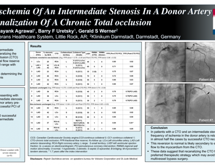 Evaluating Ischemia Of An Intermediate Stenosis In A Donor Artery During Recanalization Of A Chronic Total Occlusion