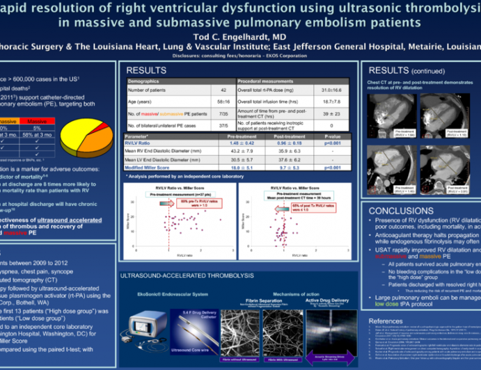 Rapid resolution of right ventricular dysfunction using ultrasonic thrombolysis in massive and submassive pulmonary embolism patients