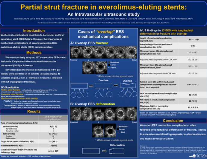 Partial strut fracture in everolimus-eluting stents: An intravascular ultrasound study