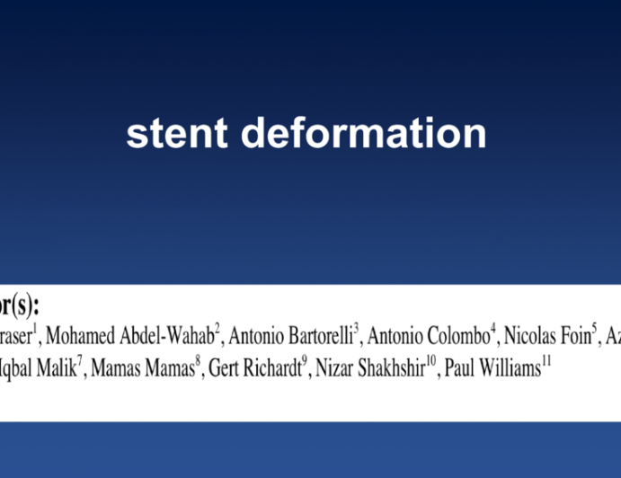 Case Series of 100 cases of longitudinal stent Deformation