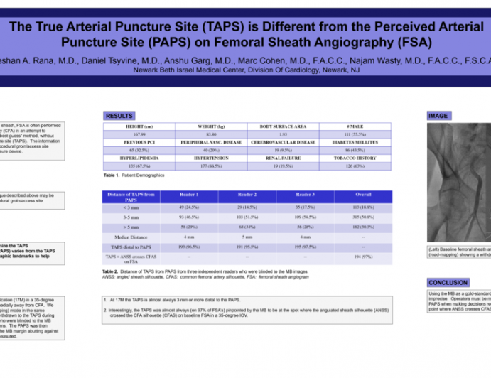 True Arterial Puncture Site (TAPS) is Different from Perceived Arterial Puncture Site (PAPS) on Femoral Sheath Angiography (FSA)