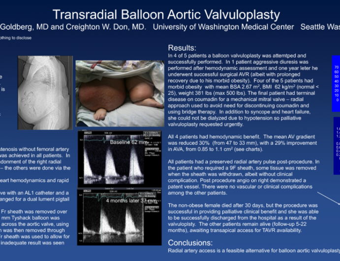 Trans-radial balloon aortic valvuloplasty