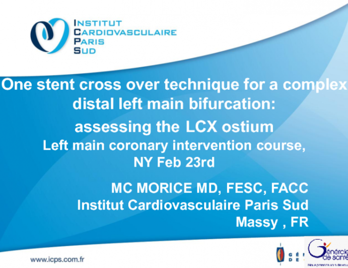 Case 4: One-Stent Crossover Technique for a Complex Distal Left Main Bifurcation: Assessing the LCX Ostium