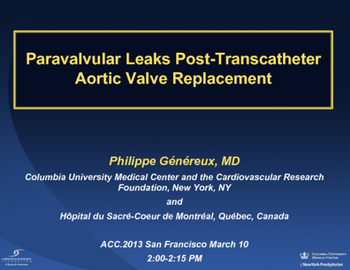 Paravalvular Leaks Post-Transcatheter Aortic Valve Replacement