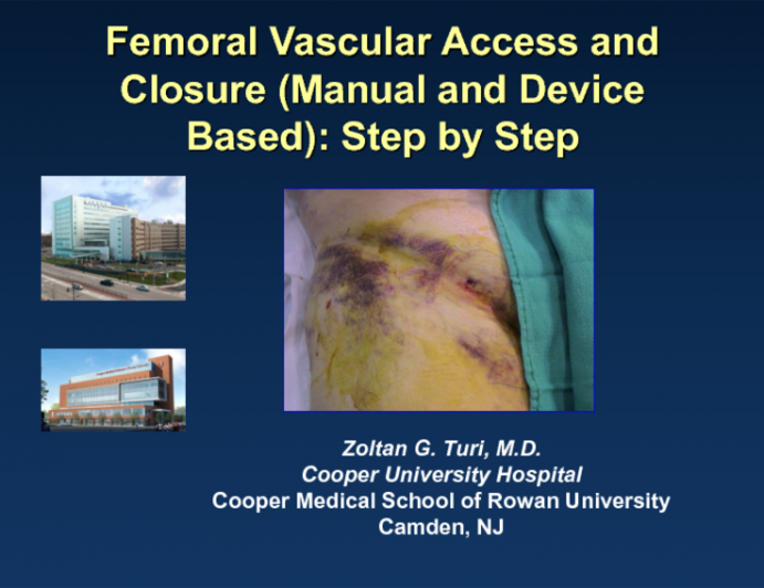 Femoral Vascular Access and Closure (Manual and Device Based): Step by Step